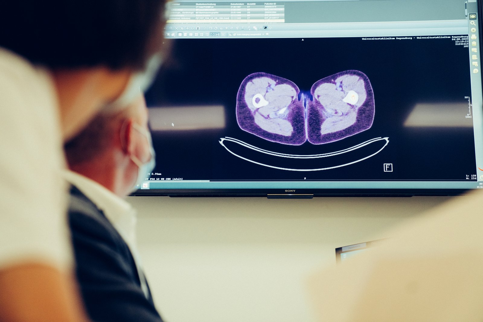 Urologic Oncology Treatment at Helios Hospital Krefeld